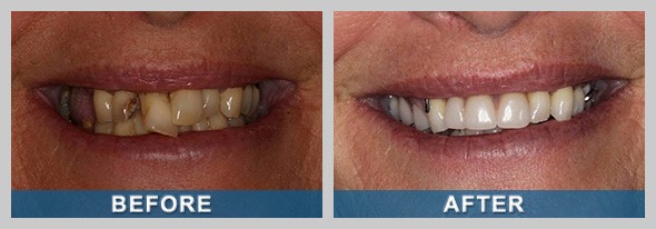 Karadent Dentures Miami FL 33173